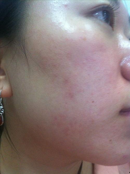 热门话题我脸上长痣了,揭秘脸上痣的成因与护理方法